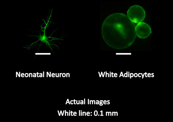 Neuron vs. WAT